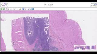 Histological description of the Ileum Peyers patches [upl. by Aettam]