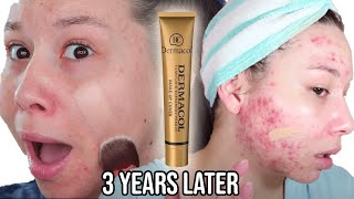 THE MOST FULL COVERGE FOUNDATION  Dermacol on DRY  ACNE Skin [upl. by Ena]