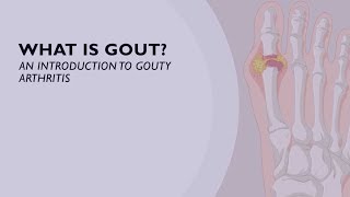 What is Gout An Introduction to Gouty Arthritis 1 of 6 [upl. by Silvan767]