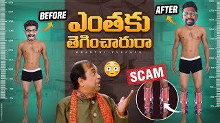 ఎత్తు పెరగడం ఎలా  Why Indian Youth Going For Limb Lengthening Procedure  Kranthi Vlogger [upl. by Bourque]