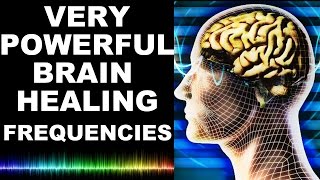 EXTREME BRAIN HEALING FREQUENCIES FOR STUDY FOCUS MIND POWER CONFIDENCE MEDITATION  MUST TRY [upl. by Anirec]