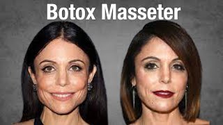 Injection Botox au Masséter Pour un visage plus Ovale stopper les grincements des dents [upl. by Janet]