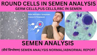 ROUND CELLS IN THE SEMEN ITS SIGNIFICANCEGERM CELLSWBC RBC EPITHELIAL CELLS IN SEMEN ANALYSIS [upl. by Ayhtnic]