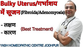 Bulky Uterus  Enlarged Uterus  Fibroid Adenomyosis  Treatment without surgery [upl. by Alaek]