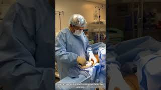 VASER Liposuction for Lipedema  Is It Helpful  Dr Boris Volshteyn [upl. by Luise]