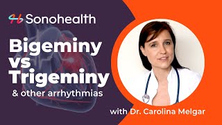 Bigeminy vs Trigeminy  PVCs amp Arrhythmias [upl. by Lanni65]