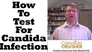 How To Test For Candida Yeast Infection [upl. by Nairim352]