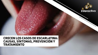 Crecen los casos de escarlatina causas síntomas prevención y tratamiento [upl. by Ilocin]