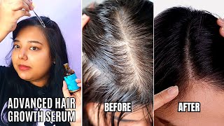 How To Apply Pilgrim Hair Growth Serum For Hair Regrowth Pilgrim Redensyl Anagain Hair Growth Serum [upl. by Yemorej]