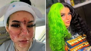 TikTok star BeastEater confirms infection ‘almost killed me’ [upl. by Atinahs]