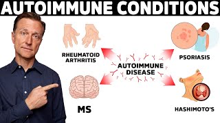 7 Surprising Causes of Autoimmune Diseases They Never Told You About [upl. by Nika]