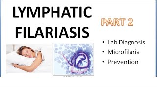 PSM 290 Lymphatic Filariasis Part 2 Lab Diagnosis Microfilaria Prevention DEC Provocation Test [upl. by Loring413]