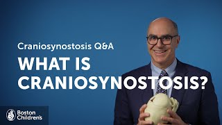 What is craniosynostosis  Boston Childrens Hospital [upl. by Naesed]