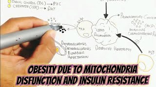 Obesity Due To Mitochondria Disfunction And Insulin Resistance Interplayobesity [upl. by Vinay]