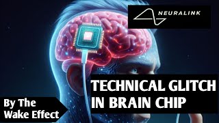 Elon Musks Neuralink Had a Brain Implant Setback Is it safe [upl. by Akir330]