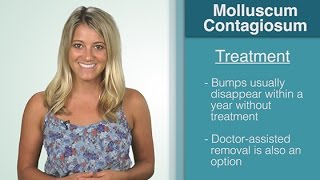 What Is  Molluscum Contagiosum [upl. by Elolcin269]