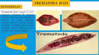 Trematoda Hati  Karlina [upl. by Nyleikcaj]