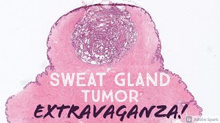 Sweat Gland Tumor Dermatopathology Board Review 31 Slides  Pathology Dermpath Dermatology [upl. by Keeley]