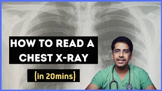 How to read a chest Xray in 20 mins [upl. by Bartram514]