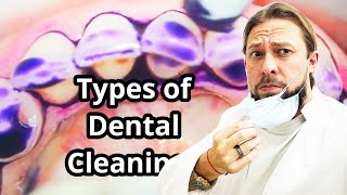 4 Types of Dental Cleanings  Scaling and Root Planing Cleaning teethcleaning toothbrushing dent [upl. by Yvon119]