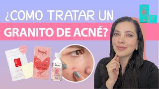 COMO TRATAR BROTES DE ACNÉ 👩🏻‍⚕️ Dermatóloga te da tips [upl. by Bordy]