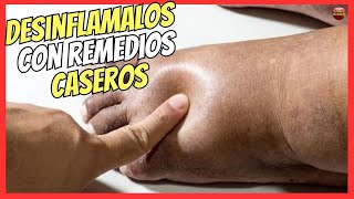 🔴 ¿COMO DESINFLAMAR LOS PIES HINCHADOS CON REMEDIOS CASEROS 🔥 [upl. by Ayatal782]