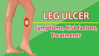 LEG ULCER  Symptoms Risk factorsTreatments [upl. by Redle]