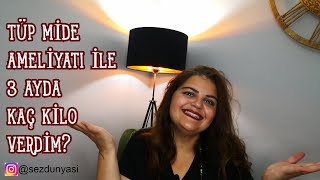 TÜP MİDE AMELİYATI İLE 3 AYDA KAÇ KİLO VERDİM [upl. by Ursuline554]