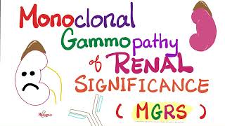 Monoclonal Gammopathy of Renal Significance MGRS  Plasma Cell Disorder  Hematology  Oncology [upl. by Jemmie]