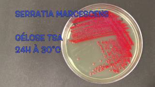 Serratia marcescens [upl. by Innor]