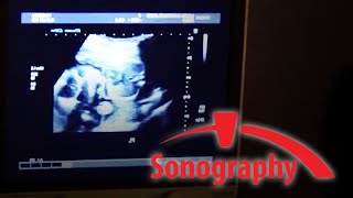 SONO – Sonography  BRCC [upl. by Eissirc]