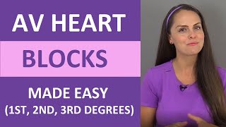 Third degree heart block complete A V block ECG interpretation of complete heart block [upl. by Gmur]