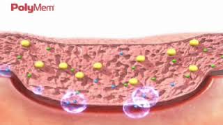 How PolyMem Wound Dressing Works [upl. by Castara]