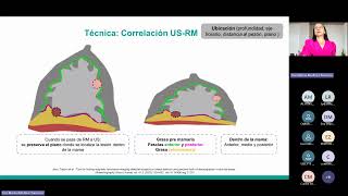 Ecografía mamaria [upl. by Poucher]