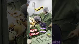 2 minutes mein Laser FISSURE Surgery I Fissure in ano Treatment I Operation kaise hota hai I PILES [upl. by Llerrod485]