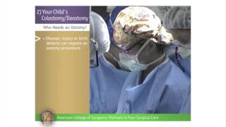 Pediatric ColostomyIleostomy Your Childs ColostomyIleostomy [upl. by Imarej]