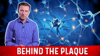 What is Plaque and How to Remove it Explained By Dr Berg [upl. by Anelaf]