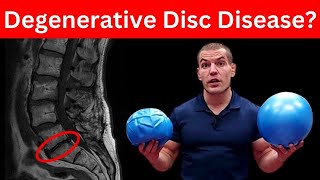 4 MustDo Exercises For Degenerative Discs In Lower Back Dont Skip These [upl. by Robinetta]