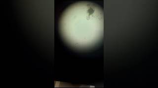 zooplankton in water experiment zoology insects science msc [upl. by Modeerf]