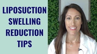 Liposuction Healing amp Recovery Tips  How to REDUCE Lipo Swelling  Post Liposuction Care Guide [upl. by Melli871]