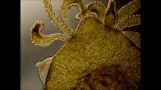 Sexual Reproduction in Chlorohydra viridissima Hydra viridis [upl. by Coussoule]