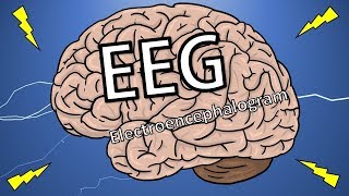 EEG టెస్ట్ అంటే ఏమిటి  What is Electro Encephalogram Test   Health Tips [upl. by Irovi]