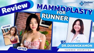 Review Mammoplasty for Runner by DrDuangkamon Yanhee Hospital [upl. by Aleirbag]