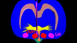 Lesions of the ventromedial and lateral nuclei [upl. by Neetsirk537]