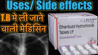 Combutol Tablet  Ethambutol Hydrochloride Tablet  TB ki Dawa  TB Medicine  Dose Side Effects [upl. by Jehias668]