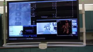 Inside Grand River Hospitals new interventional radiology suite [upl. by Aiuqram]