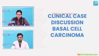 Basal Cell Carcinoma Dr Chesta Agarwal DERMATOLOGY [upl. by Cirillo]