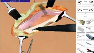 Hernia Repair  Open Surgery Simulation [upl. by Nirre330]