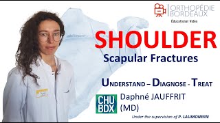 Fracture de la Scapula par le Dr Jauffrit [upl. by Hendrick]