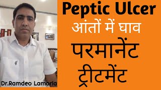 Duodenal Ulcer  पेट और आंतो के अल्सर  Peptic Ulcer Causes Symptoms amp Treatment  Gastric Ulcer [upl. by Flyn]